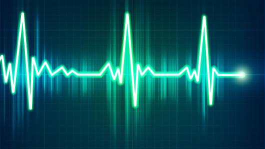 ECG waves on monitor.